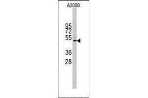 Image no. 1 for anti-Cyclin E1 (CCNE1) (C-Term) antibody (ABIN358767) (Cyclin E1 antibody  (C-Term))