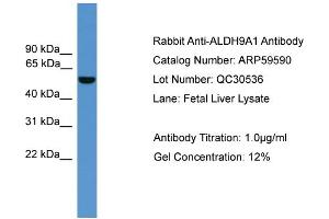 WB Suggested Anti-ALDH9A1  Antibody Titration: 0. (ALDH9A1 antibody  (C-Term))