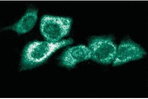 Immunofluorescent staining of Hs 766T cells. (RPS6KA1 antibody  (AA 1-184))