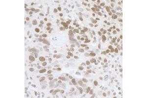 Immunohistochemistry (IHC) image for anti-Fused in Sarcoma (FUS) (AA 1-50) antibody (ABIN7454607) (FUS antibody  (AA 1-50))