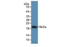 Detection of Recombinant HSPb6, Rat using Monoclonal Antibody to Heat Shock Protein Beta 6 (HSPb6) (HSPB6 antibody  (AA 1-162))