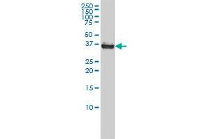 NPM1 monoclonal antibody (M01), clone 3B2 Western Blot analysis of NPM1 expression in Hela S3 NE . (NPM1 antibody  (AA 1-294))