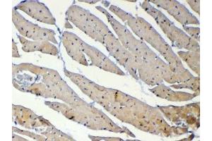 IHC testing of FFPE mouse heart tissue with Dnmt1 antibody at 1ug/ml.
