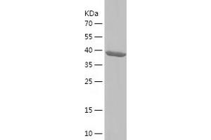Western Blotting (WB) image for EH-Domain Containing 4 (EHD4) (AA 1-171) protein (His-IF2DI Tag) (ABIN7284000) (EHD4 Protein (AA 1-171) (His-IF2DI Tag))