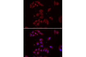 Immunofluorescence analysis of U2OS cell using NPHP1 antibody. (NPHP1 antibody)