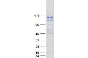 Validation with Western Blot (OCRL Protein (Transcript Variant A) (Myc-DYKDDDDK Tag))