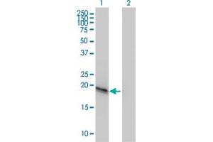 Western Blot analysis of C20orf102 expression in transfected 293T cell line by C20orf102 monoclonal antibody (M01), clone 3B9. (VSTM2L antibody  (AA 25-204))