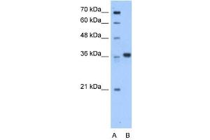 AASDHPPT antibody used at 0. (AASDHPPT antibody  (C-Term))