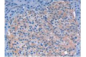 IHC-P analysis of Human Pancreas Tissue, with DAB staining. (LIF antibody  (AA 2-201))