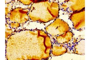 Immunohistochemistry of paraffin-embedded human thyroid tissue using ABIN7156373 at dilution of 1:100 (IGFBP6 antibody  (AA 32-161))