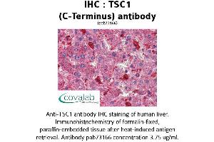 Image no. 1 for anti-Tuberous Sclerosis 1 (TSC1) (C-Term) antibody (ABIN1740408) (TSC1 antibody  (C-Term))