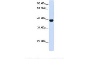 Image no. 1 for anti-Forkhead Box E1 (Thyroid Transcription Factor 2) (FOXE1) (AA 254-303) antibody (ABIN6737656) (FOXE1 antibody  (AA 254-303))