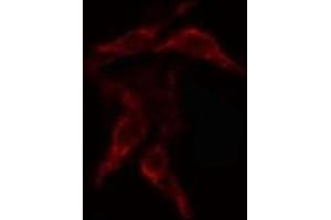 ABIN6268812 staining Hela cells by IF/ICC. (COL4a2 antibody  (N-Term))