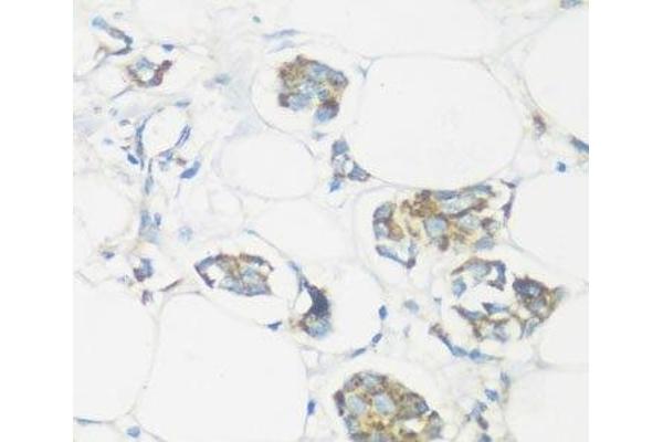 NMT1 antibody