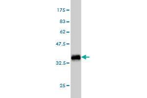 Western Blot detection against Immunogen (36. (TEK antibody  (AA 701-800))