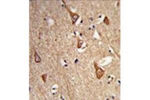 Formalin-fixed,  paraffin-embedded human brain tissue reacted with Complexin-1 Antibody (Center) followed which was peroxidase-conjugated to the secondary antibody, followed by DAB staining. (Complexin 1 antibody  (Middle Region))