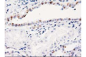 Immunohistochemistry (IHC) image for anti-Integral Membrane Protein 2B (ITM2B) antibody (ABIN1496395) (ITM2B antibody)