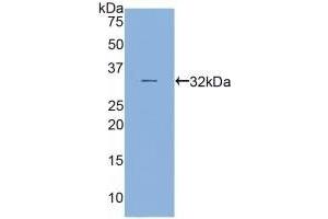 Detection of Recombinant MYH16, Human using Polyclonal Antibody to Myosin Heavy Chain 16 (MYH16) (MYH16 antibody  (AA 209-469))