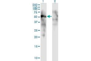 Western Blot analysis of FOXD1 expression in transfected 293T cell line by FOXD1 monoclonal antibody (M01), clone 2C10. (FOXD1 antibody  (AA 1-91))