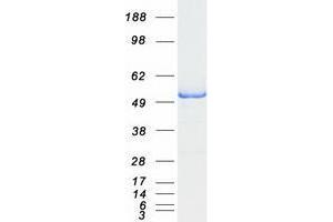 Validation with Western Blot