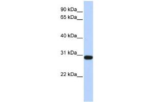 WB Suggested Anti-BPGM Antibody Titration: 0. (BPGM antibody  (Middle Region))