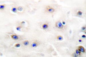 Image no. 2 for anti-Tyrosine Hydroxylase (TH) antibody (ABIN271857) (Tyrosine Hydroxylase antibody)