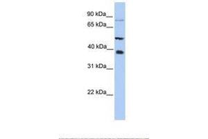 Image no. 1 for anti-Methyltransferase Like 2B (METTL2B) (N-Term) antibody (ABIN6738511) (METTL2B antibody  (N-Term))