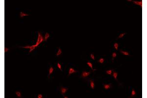 ABIN6269195 staining MCF-7 cells by IF/ICC. (GATA3 antibody)