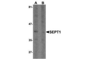 Western blot analysis of SEPT1 in Raji cell lysate with SEPT1 Antibody  at 1 µg/ml in (A) the absence and (B) the presence of blocking peptide.