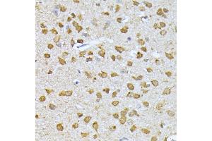 Immunohistochemistry of paraffin-embedded mouse brain using RPS27A antibody (ABIN3022728, ABIN3022729, ABIN1513489, ABIN1514633 and ABIN6219198) at dilution of 1:100 (40x lens). (RPS27A antibody  (AA 1-156))