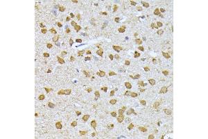 Immunohistochemistry of paraffin-embedded mouse brain using RPS27A antibody (ABIN3022728, ABIN3022729, ABIN1513489, ABIN1514633 and ABIN6219198) at dilution of 1:100 (40x lens). (RPS27A antibody  (AA 1-156))