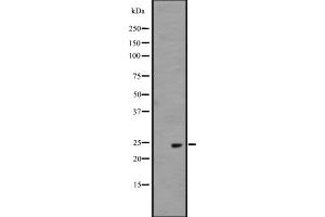 Western blot analysis of BAG2 expression in Hela cell lysate,The lane on the left is treated with the antigen-specific peptide. (BAG2 antibody  (C-Term))