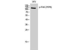Western Blotting (WB) image for anti-PTK2 Protein tyrosine Kinase 2 (PTK2) (pTyr576) antibody (ABIN3179639) (FAK antibody  (pTyr576))