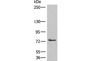 Western blot analysis of 293T cell lysate using MCMBP Polyclonal Antibody at dilution of 1:800 (MCMBP antibody)