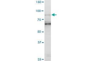 PCAF monoclonal antibody (M06), clone 5E5. (KAT2B antibody  (AA 353-452))