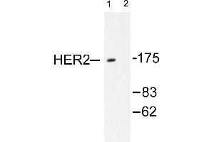 Image no. 1 for anti-Receptor tyrosine-protein kinase erbB-2 (ErbB2/Her2) antibody (ABIN265464) (ErbB2/Her2 antibody)