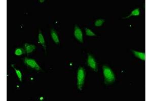 Immunofluorescent analysis of Hela cells using ABIN7152417 at dilution of 1:100 and Alexa Fluor 488-congugated AffiniPure Goat Anti-Rabbit IgG(H+L) (FBXO25 antibody  (AA 1-291))