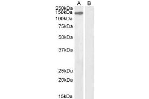 ABIN184768 (2µg/ml) staining of nuclear NIH3T3 (A) and (2ug/ml) negative control Human Ovary (B) lysate. (KIF4A antibody  (C-Term))