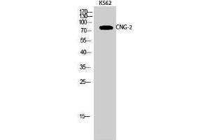 Western Blotting (WB) image for anti-Cyclic Nucleotide Gated Channel alpha 2 (CNGA2) (Internal Region) antibody (ABIN3174461) (CNGA2 antibody  (Internal Region))