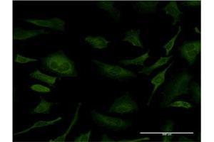 Immunofluorescence of monoclonal antibody to SFN on HeLa cell. (14-3-3 sigma/SFN antibody  (AA 1-248))