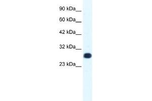 WB Suggested Anti-GTF2F2 Antibody Titration: 1. (GTF2F2 antibody  (Middle Region))
