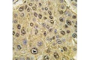 Immunohistochemistry (IHC) image for anti-Hypoxia Inducible Factor 1, alpha Subunit (Basic Helix-Loop-Helix Transcription Factor) (HIF1A) (AA 728-757) antibody (ABIN3031282)