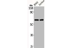 Western Blot analysis of K562 Jurkat cells using CLCC1 Polyclonal Antibody