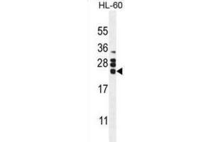 Western Blotting (WB) image for anti-Colony Stimulating Factor 2 (Granulocyte-Macrophage) (CSF2) antibody (ABIN2995782)