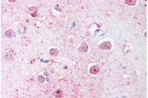 Human Brain, Cortex (formalin-fixed, paraffin-embedded) stained with LINGO1 antibody ABIN239799 at 20 ug/ml followed by biotinylated goat anti-rabbit IgG secondary antibody ABIN481713, alkaline phosphatase-streptavidin and chromogen. (LINGO1 antibody  (C-Term))