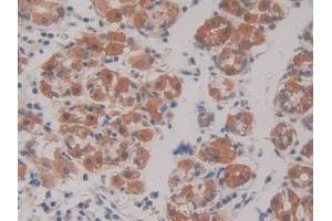 DAB staining on IHC-P; Samples: Human Stomach Tissue (GRF2 antibody  (AA 780-1035))