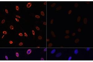 Immunofluorescence analysis of NIH/3T3 cells using Acetyl-Histone H3-K36 Polyclonal Antibody at dilution of 1:100. (Histone 3 antibody  (acLys36))
