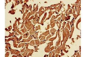 Immunohistochemistry of paraffin-embedded human heart tissue using ABIN7146522 at dilution of 1:100 (CAPNL1 antibody  (Catalytic Subunit))