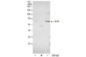 IP Image Immunoprecipitation of KLF4 protein from HeLa whole cell extracts using 5 μg of KLF4 antibody, Western blot analysis was performed using KLF4 antibody, EasyBlot anti-Rabbit IgG  was used as a secondary reagent. (KLF4 antibody  (C-Term))