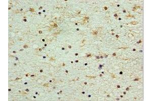 Immunohistochemistry of paraffin-embedded human brain tissue using ABIN7148846 at dilution of 1:100 (CDK1 antibody  (AA 1-283))
